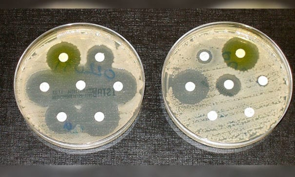 科學家的抗藥測試。經過藥物測試結果可看到，右邊試皿中4個白色點的菌株完全不受抗生素影響。（圖片來源：bigthink）