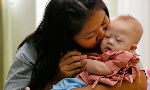 泰國代母產下小男孩Gammy，由於不符委託人期待而慘遭拋棄。(圖片來源：guim)