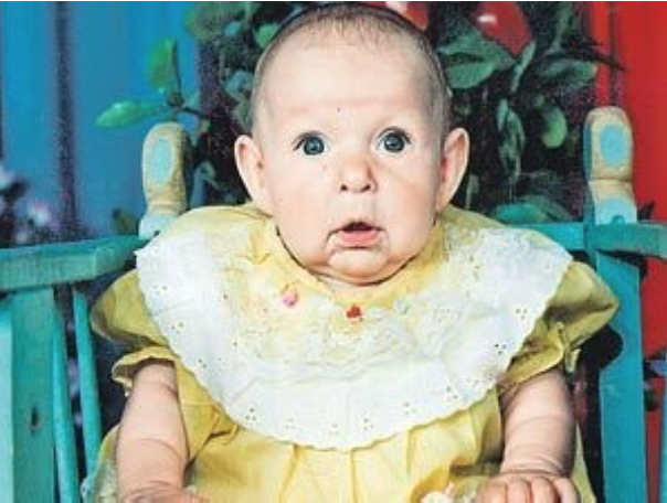 卡媞雅剛出生時滿臉皺紋。(圖片來源：翻攝網路)